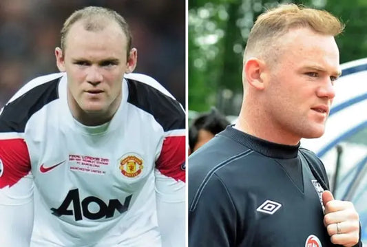 Wayne Rooney Hair Transformation