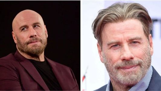 John Travolta Hair Transplant
