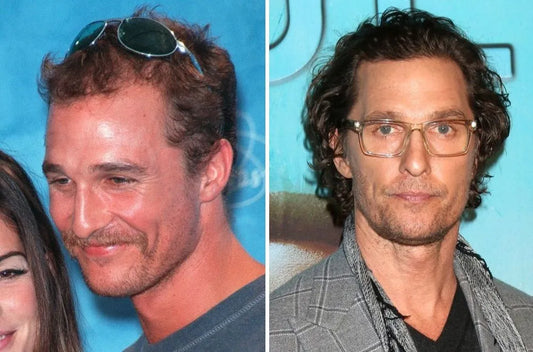 Matthew McConaughey Hair Transplant