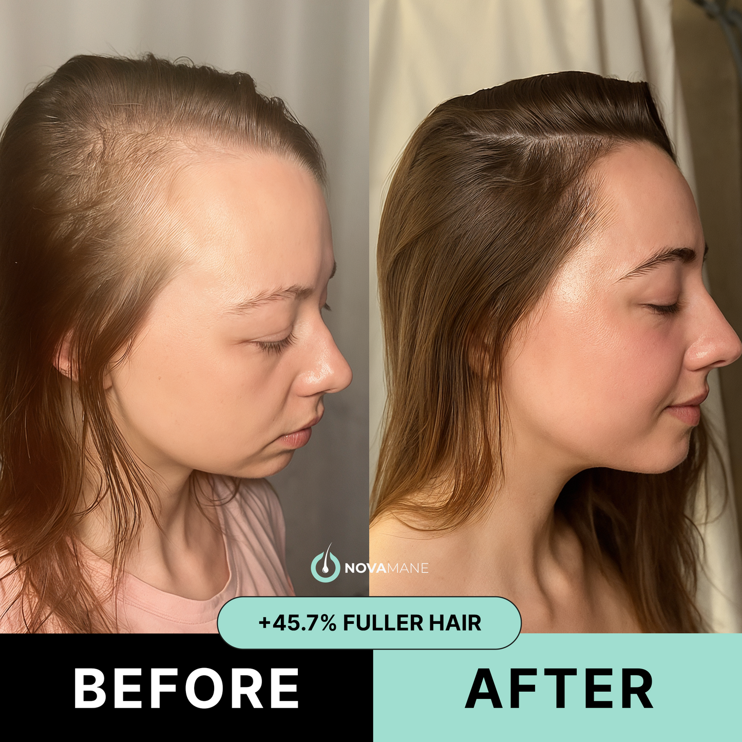 Fuller Hair