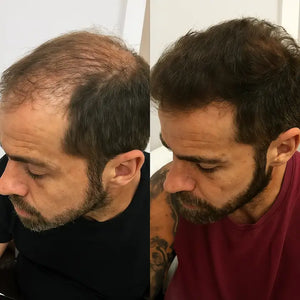 Thicker, Fuller Hairline
