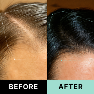 Thicker, Fuller Hairline