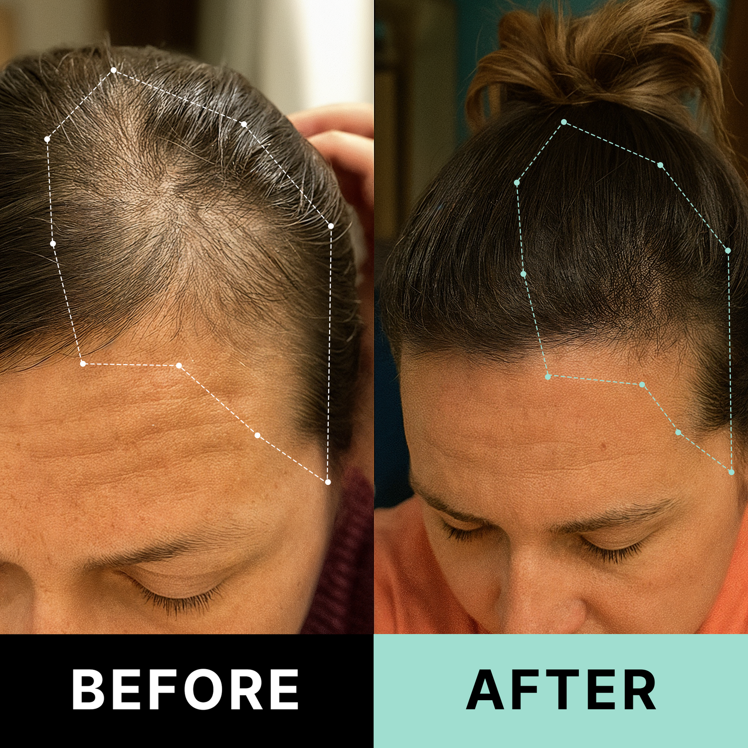 Before After Results