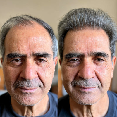 Side-by-side comparison of a man's face with and without makeup