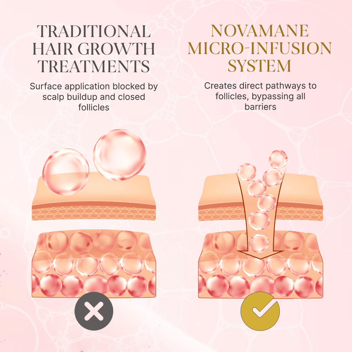Comparison of traditional hair growth treatments and Novamane micro-infusion system on a pink background.
