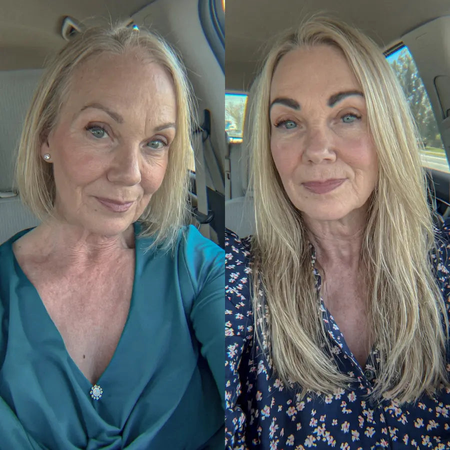 Diane P. before and after
