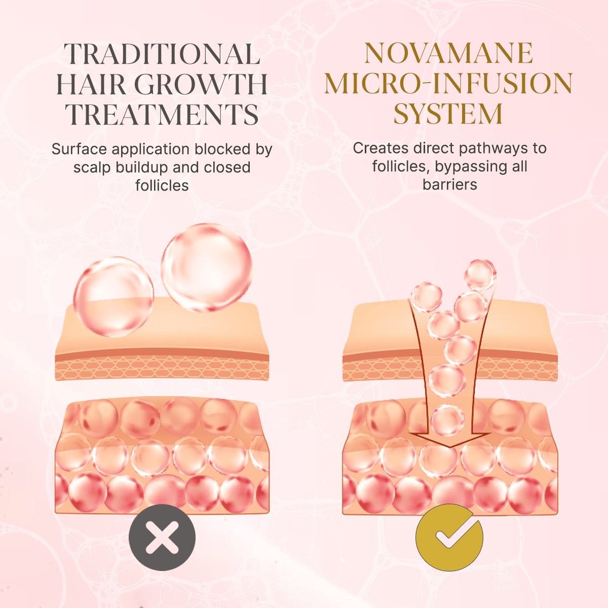 NovaMane - Hair Regrowth Micro-Infusion System For Women