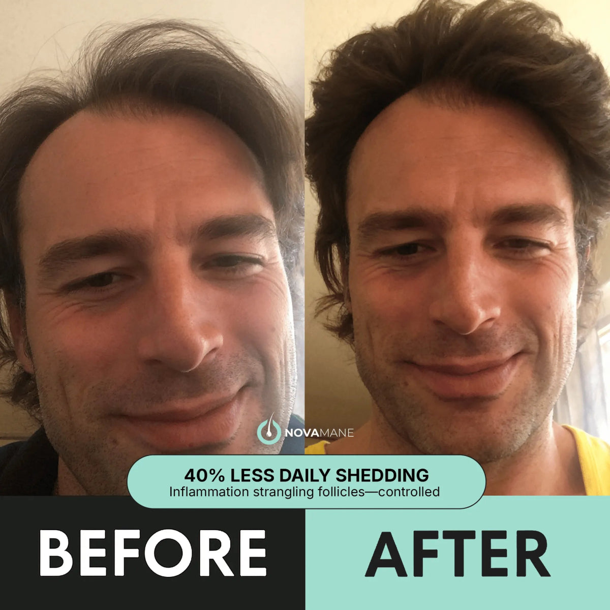 Regen 2 - in - 1 Shampoo & Conditioner (Men) - NovaMane