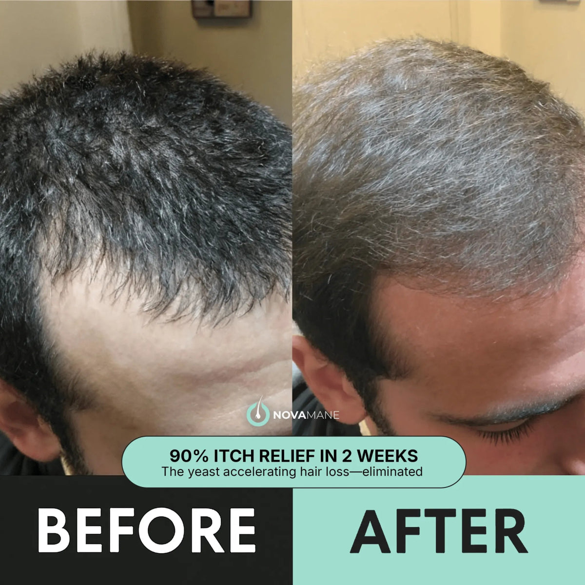 Regen 2 - in - 1 Shampoo & Conditioner (Men) - NovaMane