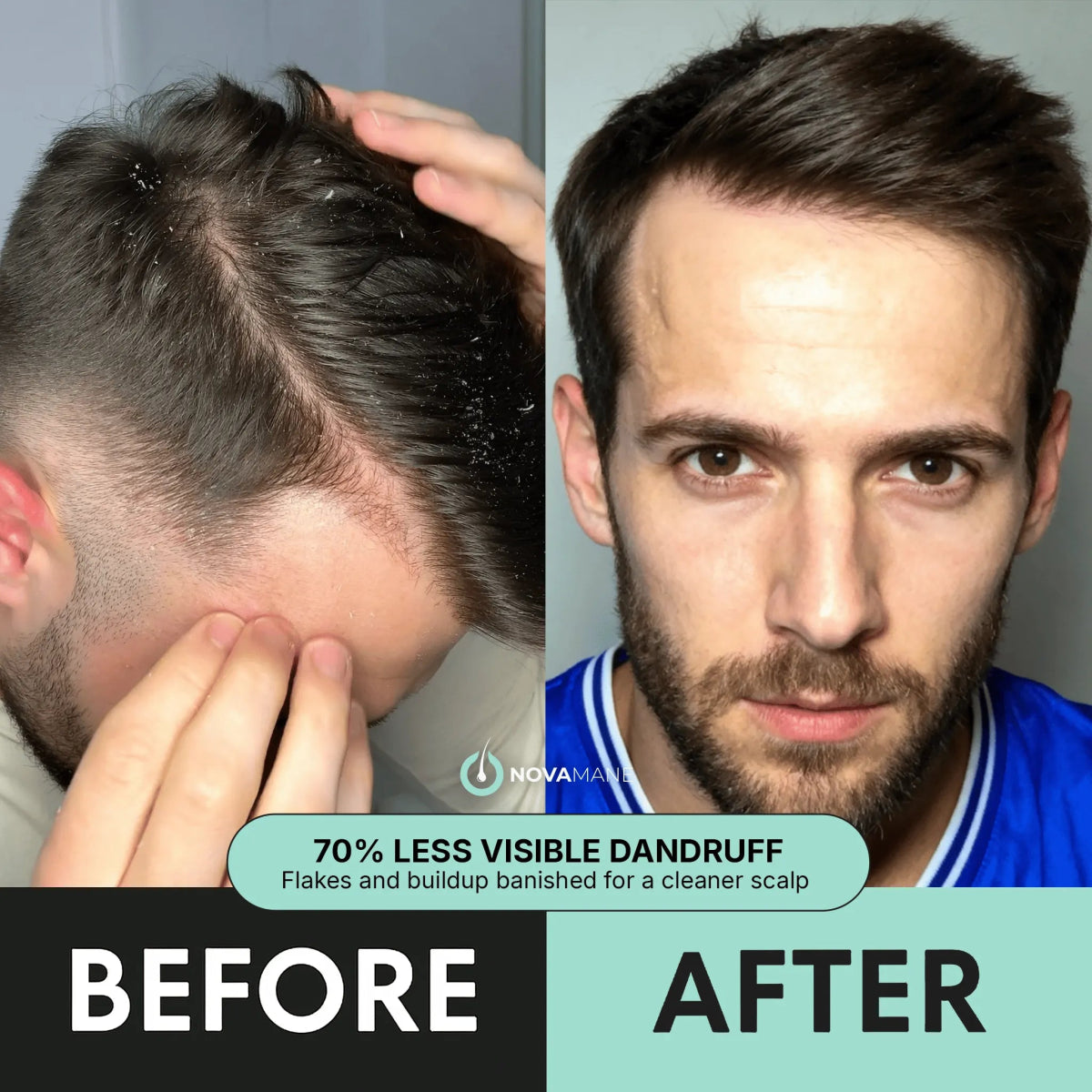 Regen 2 - in - 1 Shampoo & Conditioner (Men) - NovaMane