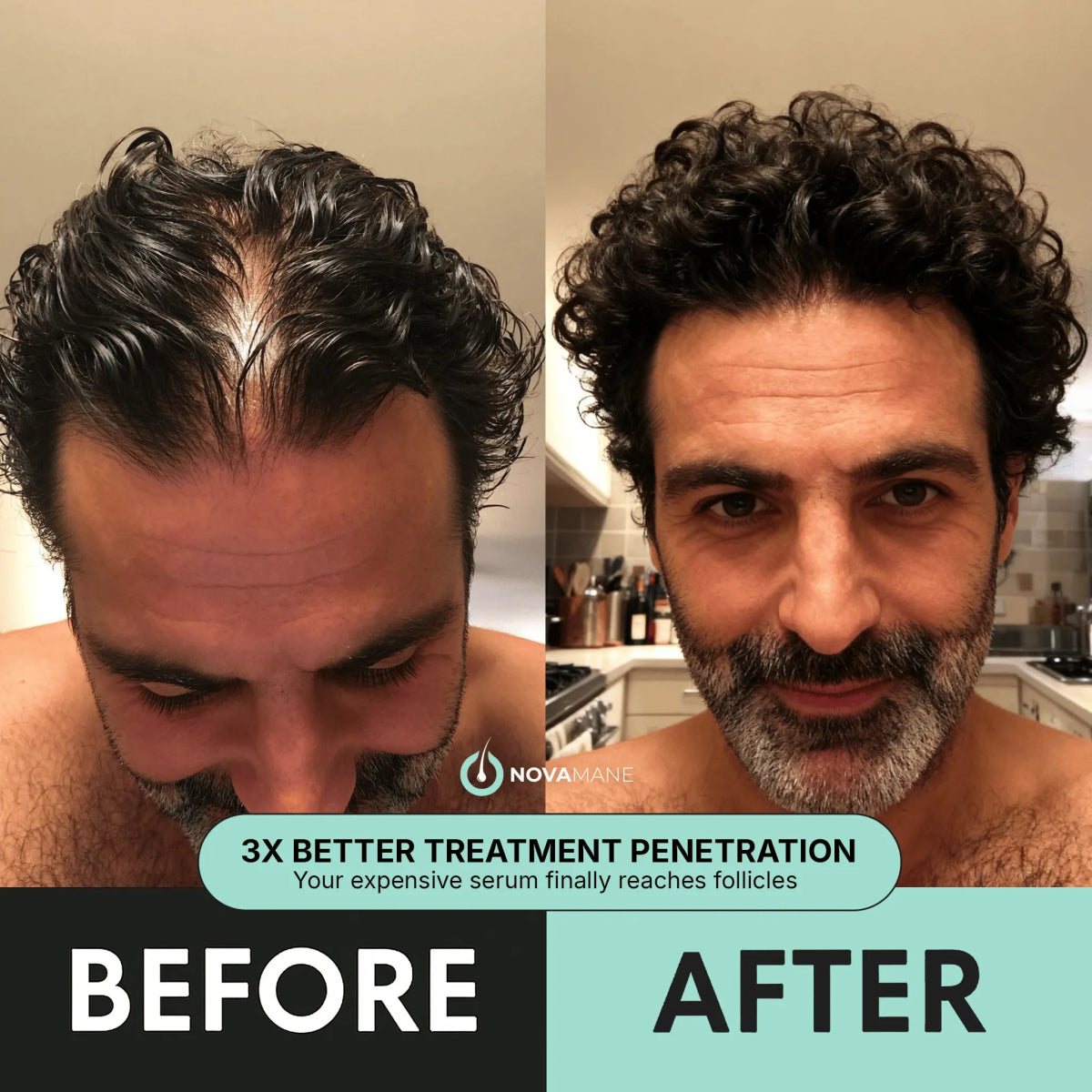 Regen 2 - in - 1 Shampoo & Conditioner (Men) - NovaMane