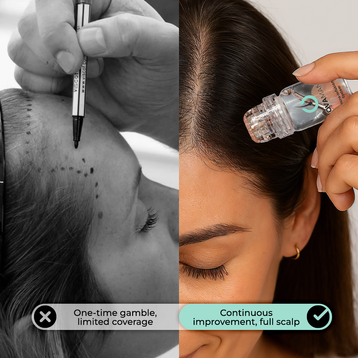 Scalp Treatment Product
