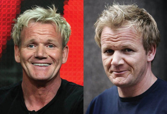 Gordon Ramsay Hair Transplant: The Chef's Secret Recipe Revealed - NovaMane