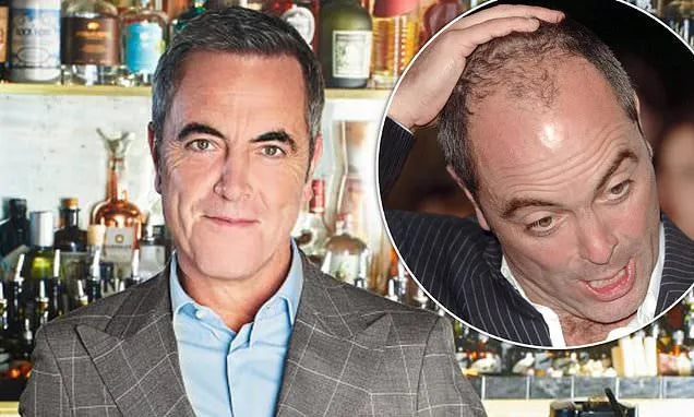 James Nesbitt Hair Transplant