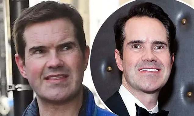 Jimmy Carr Hair Transplant