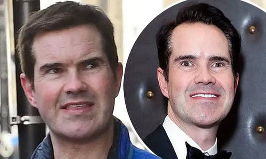 Jimmy Carr Hair Transplant