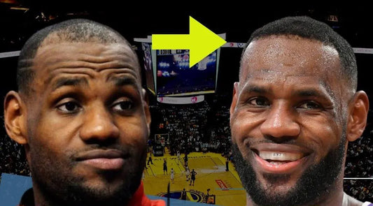 LeBron James Hair Transplant