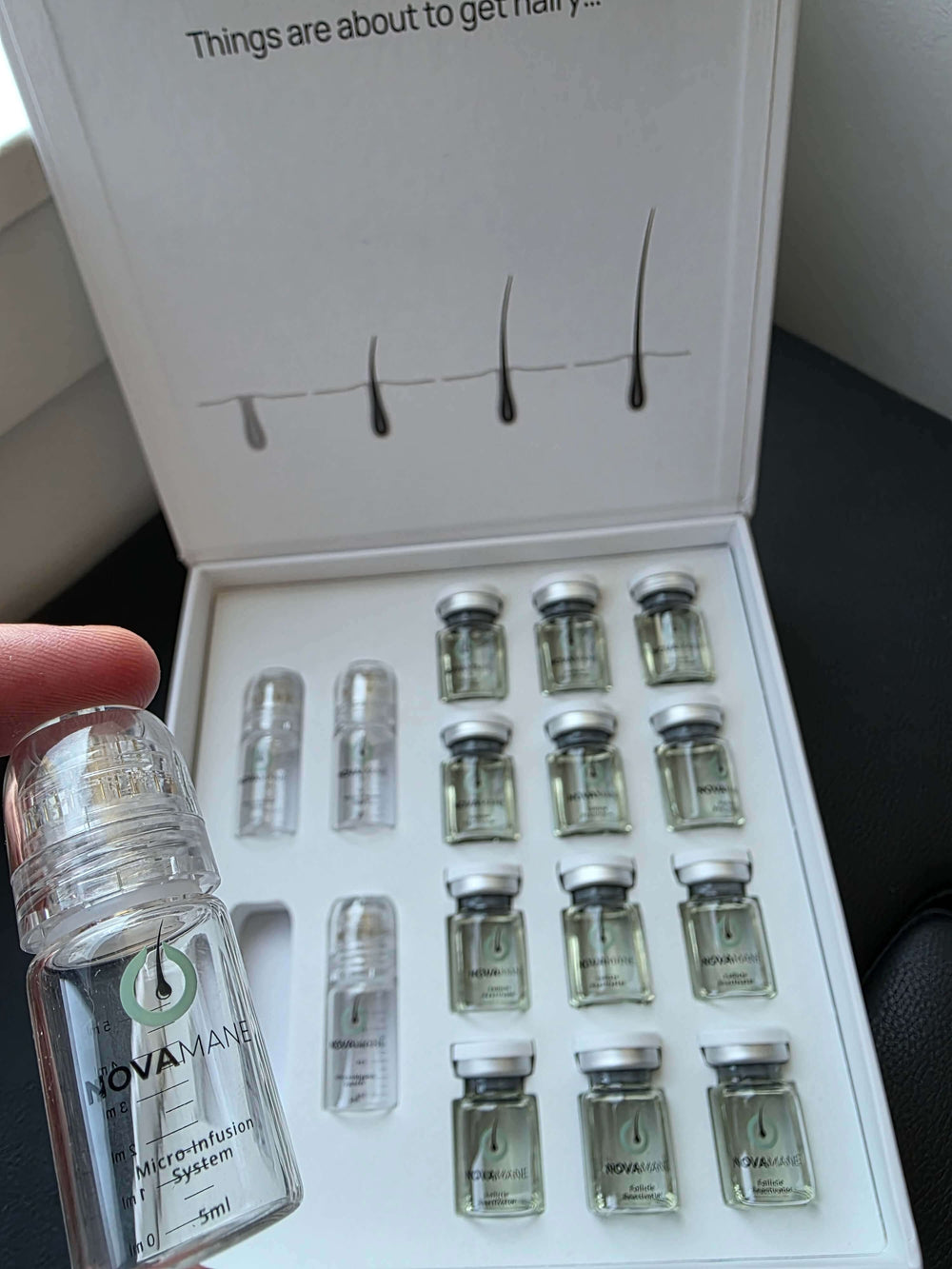 Regrowing Hair Loss From TRT – NovaMane