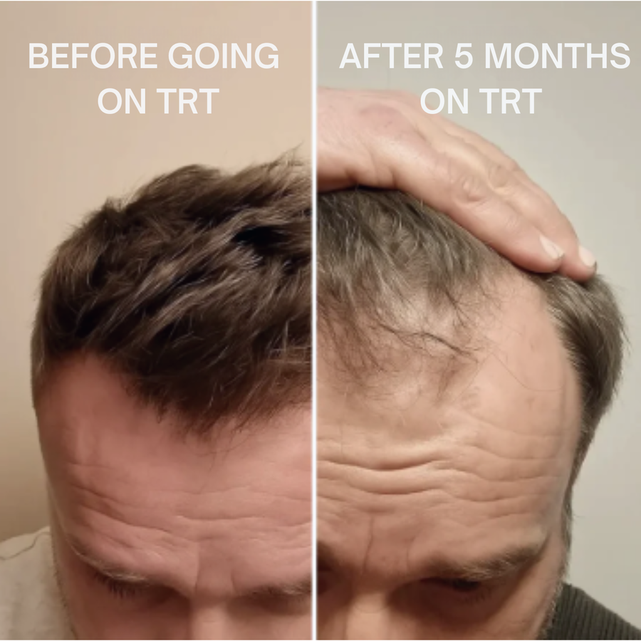 3. Scalp Absorption Barrier