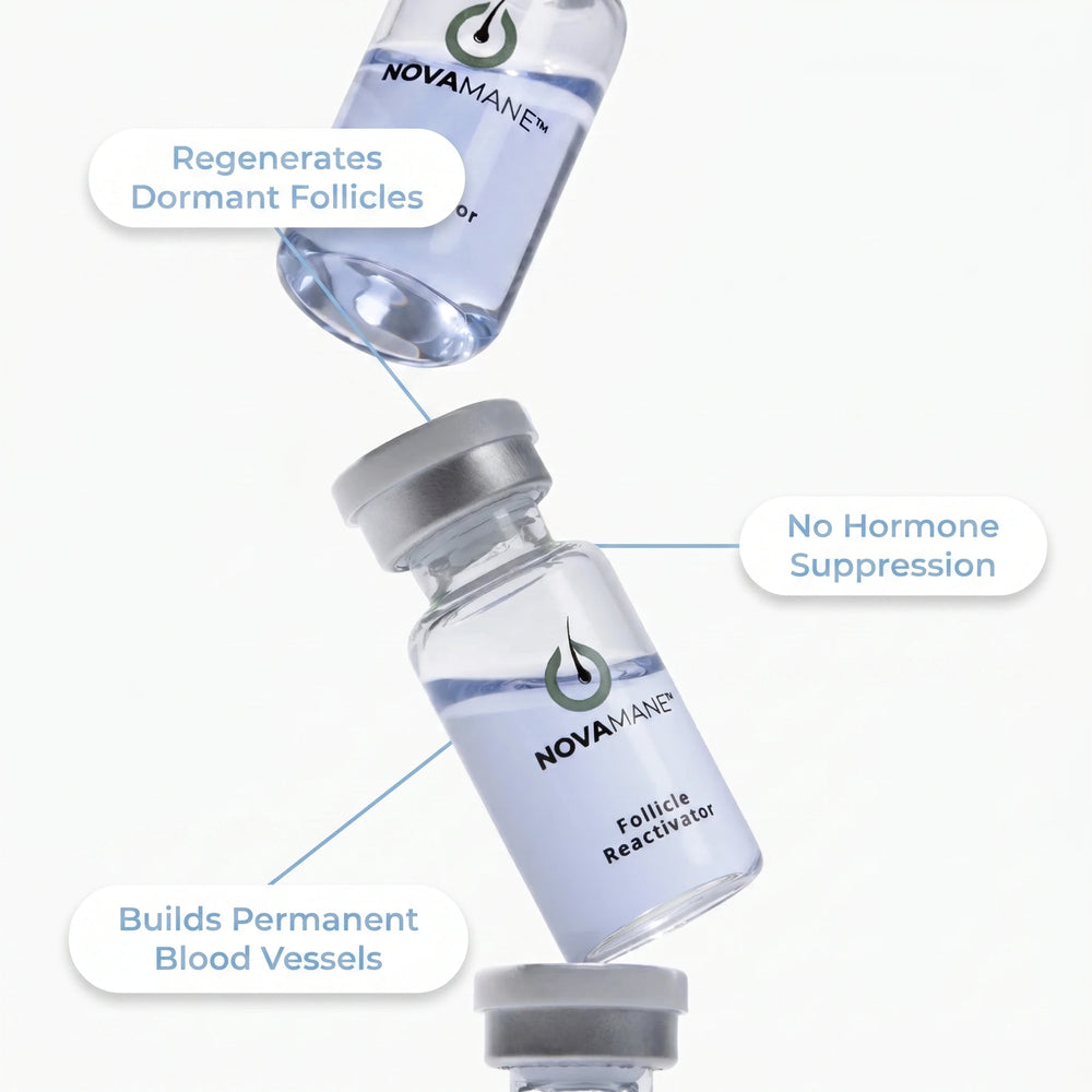 Novamane Regrowing Hair Loss From TRT – NovaMane
