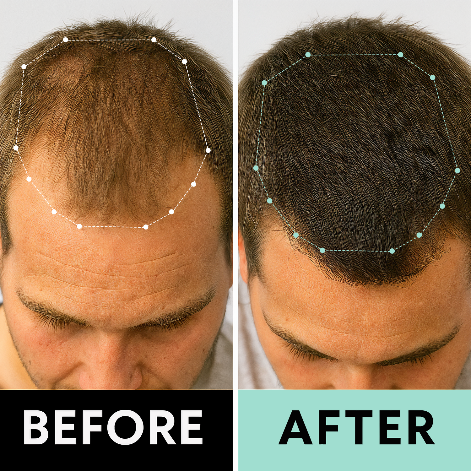 Before/After Image