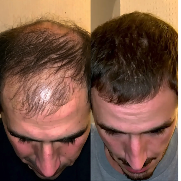 Before Treatment