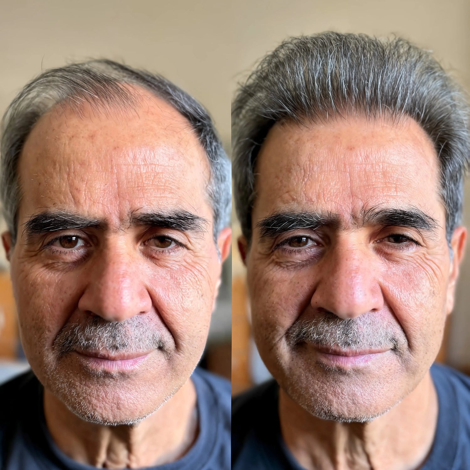 Side-by-side comparison of a man's face with and without makeup

