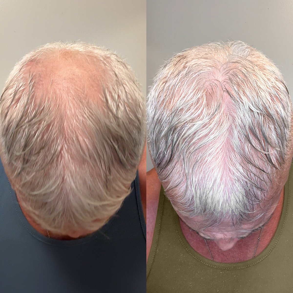 AquaGuard™ Shower Filter - NovaMane