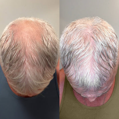 AquaGuard™ Shower Filter - NovaMane