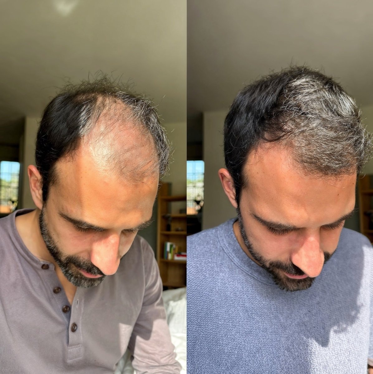 AquaGuard™ Shower Filter - NovaMane