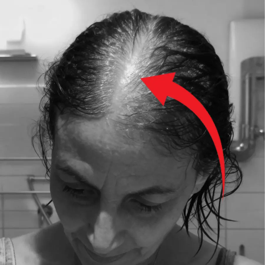 Widening part on thinning hair