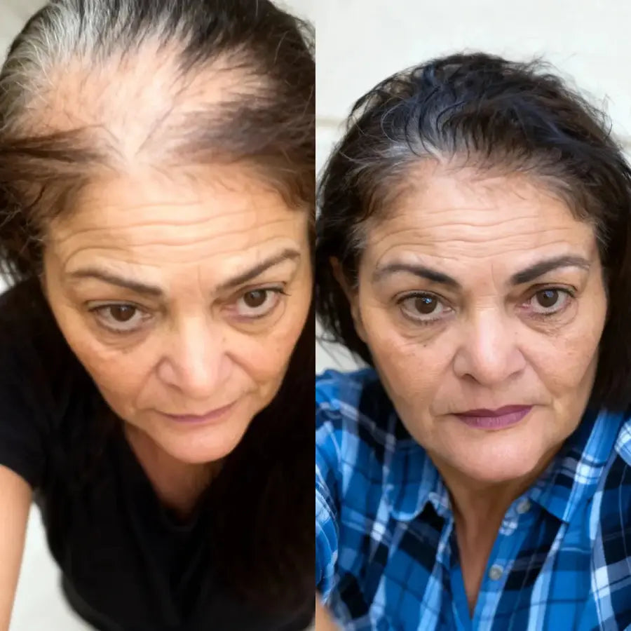 Carmen R. crown density