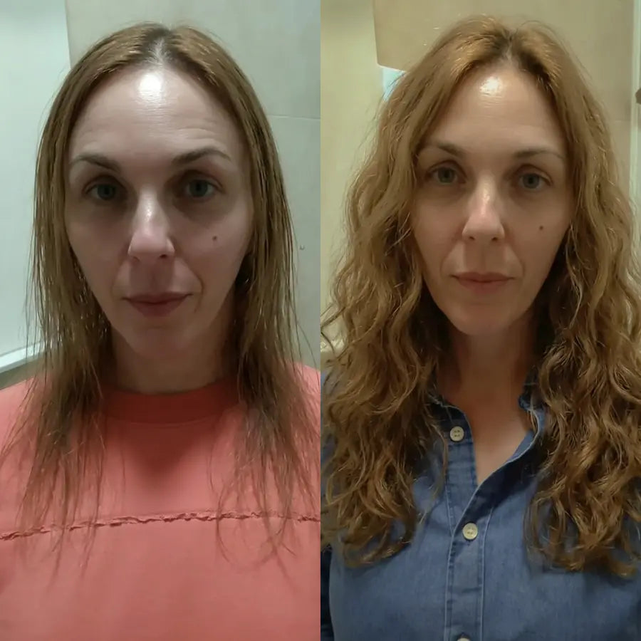 Rachel W. before and after