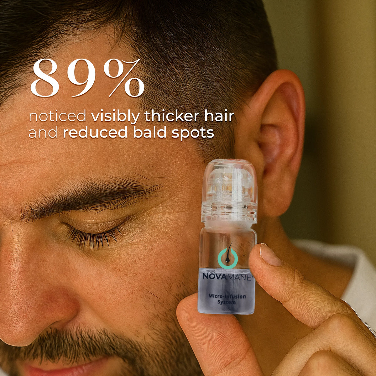 Novamane NovaMane | Men Hair Regrowth Micro-Infusion System