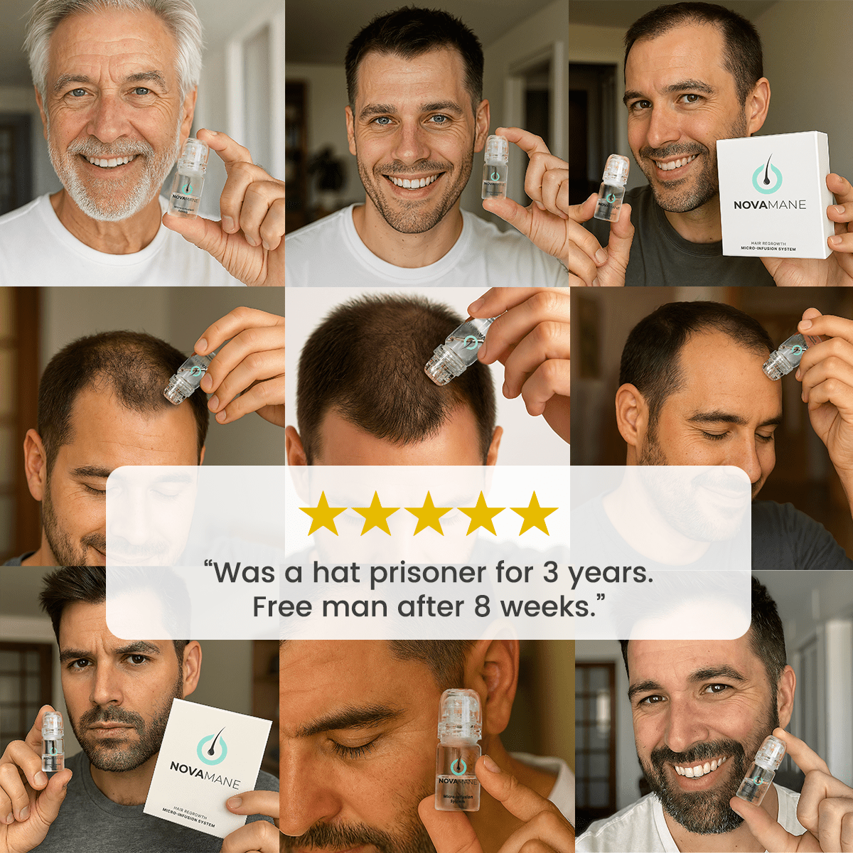 NovaMane - NovaMane Hair Regrowth Micro-Infusion System