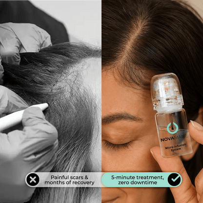 NovaMane - Hair Regrowth Micro-Infusion System For Women