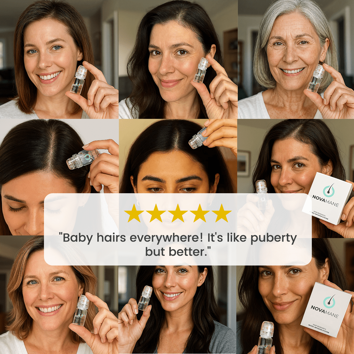 NovaMane Hair Regrowth Micro-Infusion System For Women NovaMane Hair Regrowth Micro-Infusion System For Women