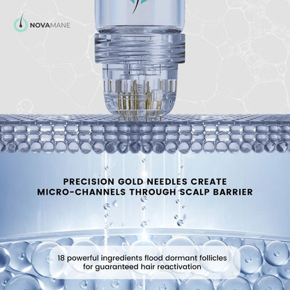 NovaMane Hair Regrowth Micro - Infusion System For Beards - NovaMane
