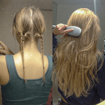 NovaMane Hair Regrowth Micro-Infusion System For Women - NovaMane