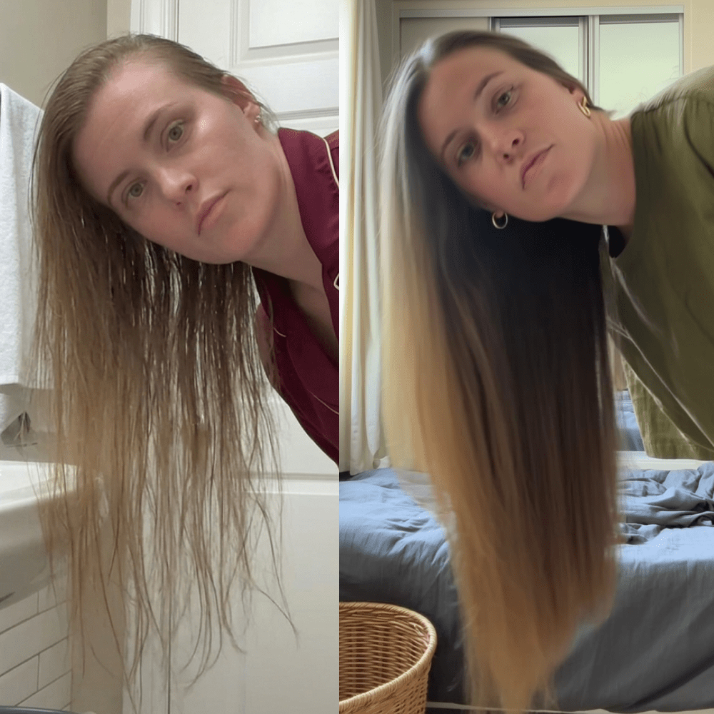NovaMane Hair Regrowth Micro-Infusion System For Women - NovaMane