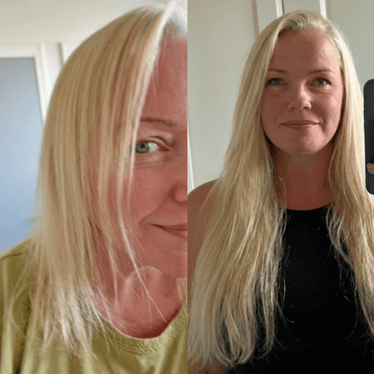 NovaMane Hair Regrowth Micro-Infusion System For Women - NovaMane