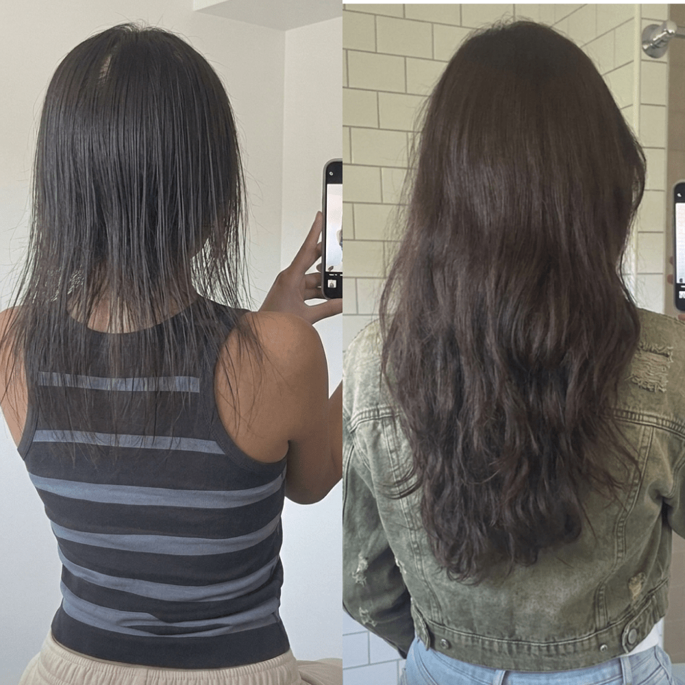 NovaMane Hair Regrowth Micro-Infusion System For Women - NovaMane