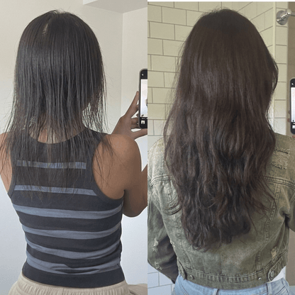 NovaMane Hair Regrowth Micro-Infusion System For Women - NovaMane
