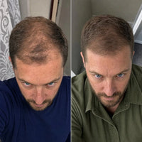 NovaMane Lumen Tri-Wave Hair Growth Laser Cap - NovaMane image 7