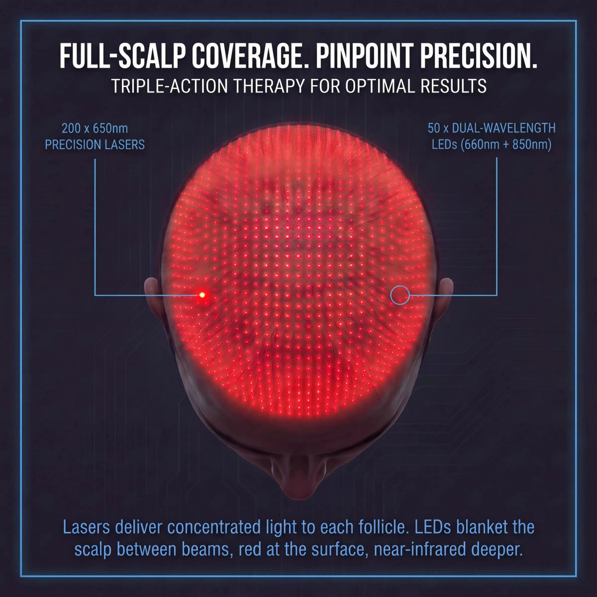 NovaMane Lumen Tri-Wave Hair Growth Laser Cap - NovaMane