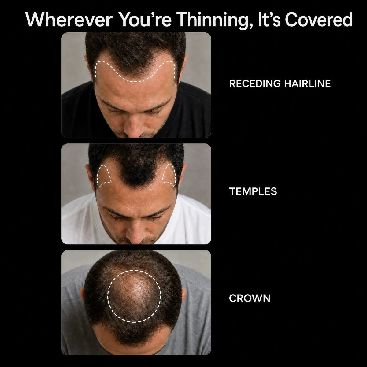 NovaMane Lumen Tri-Wave Hair Growth Laser Cap - NovaMane