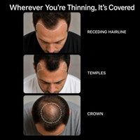 NovaMane Lumen Tri-Wave Hair Growth Laser Cap - NovaMane image 2