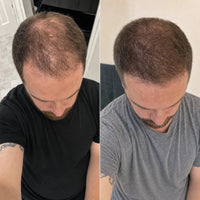 NovaMane Lumen Tri-Wave Hair Growth Laser Cap - NovaMane image 11