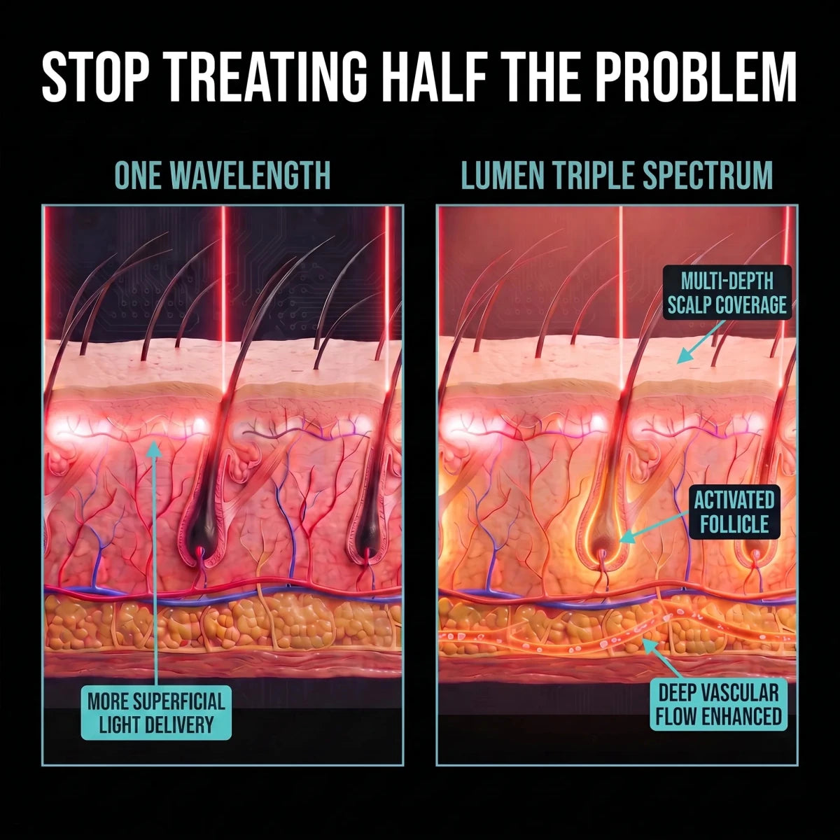 NovaMane Lumen Tri-Wave Hair Growth Laser Cap - NovaMane