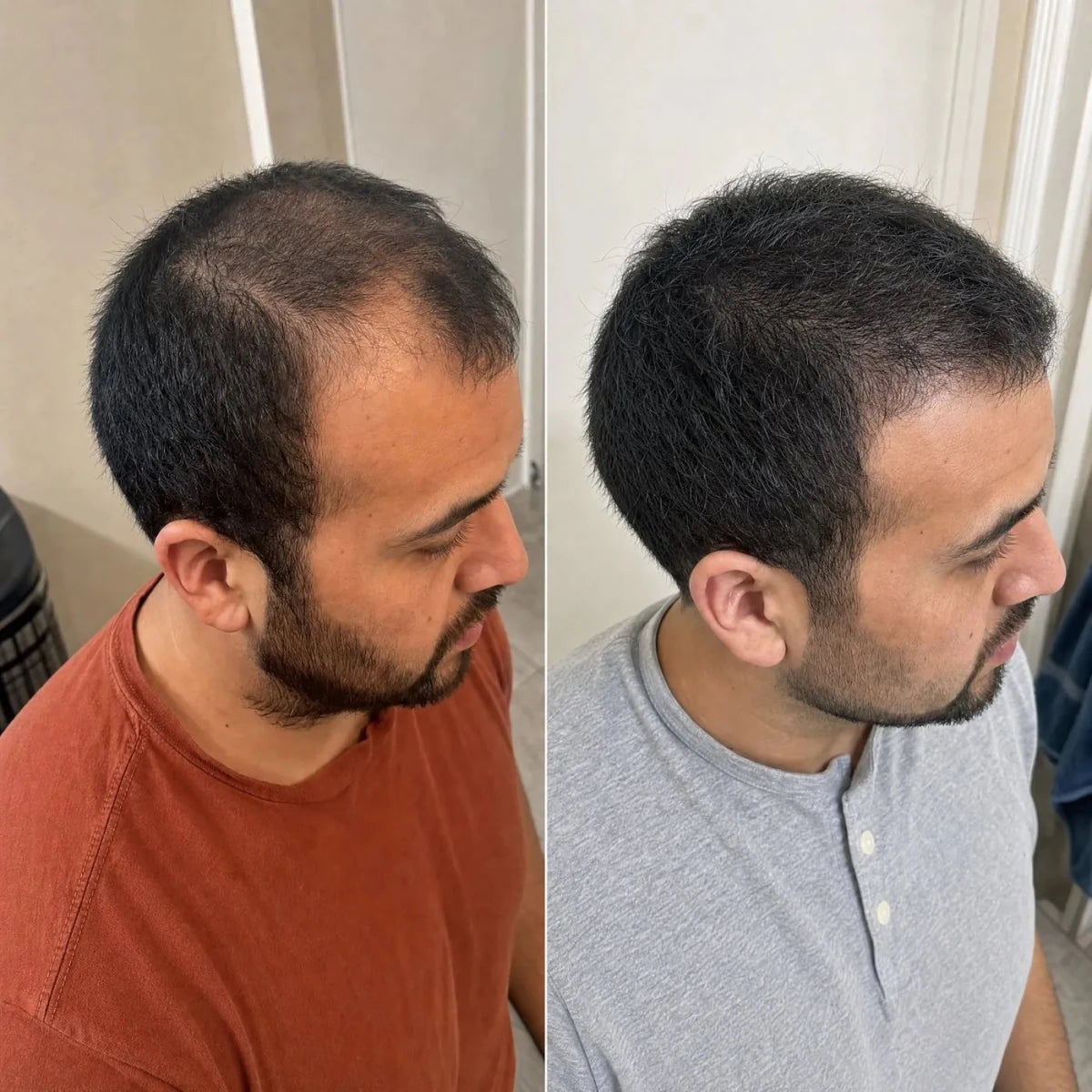 NovaMane Lumen Tri-Wave Hair Growth Laser Cap - NovaMane